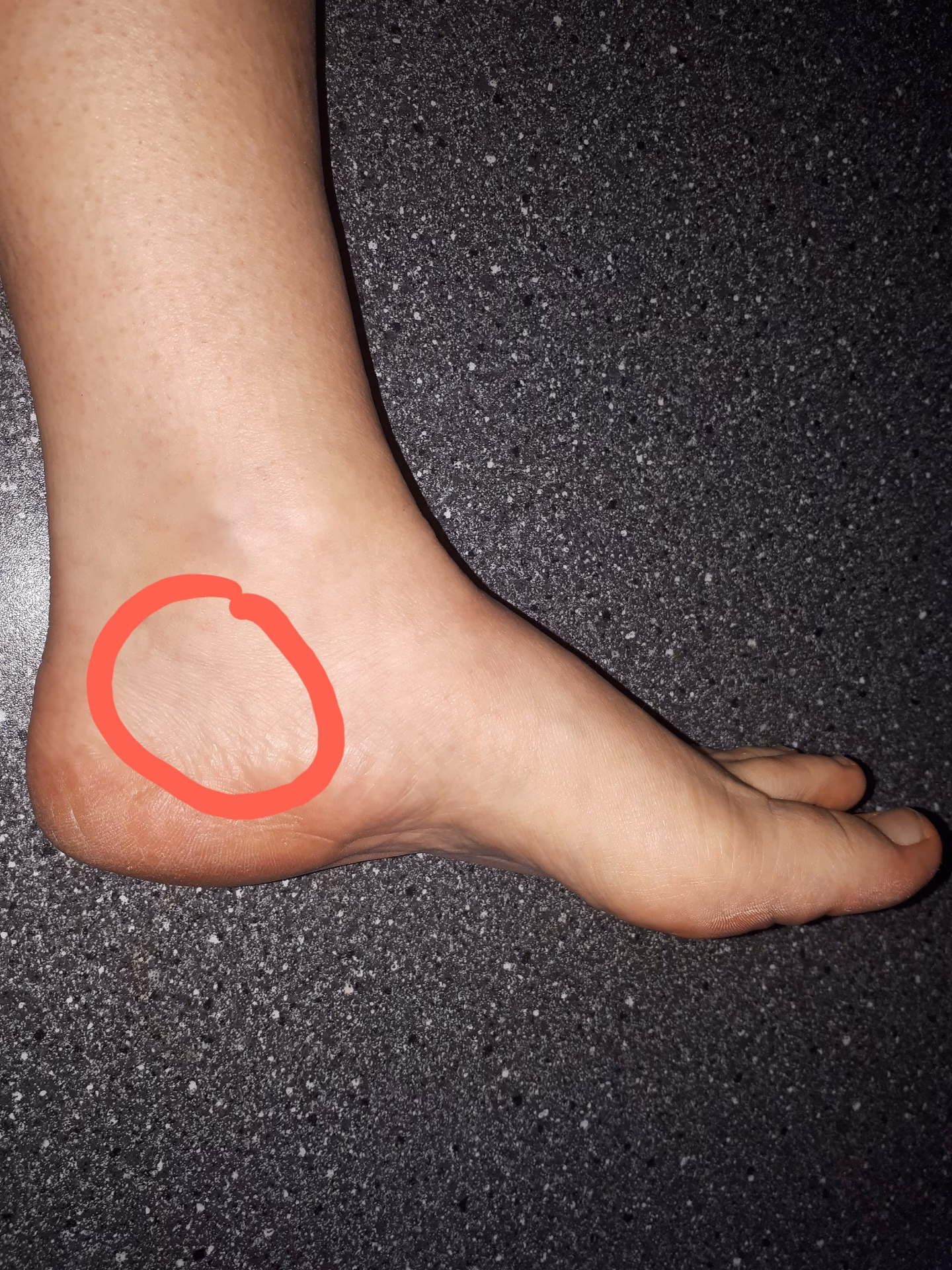 Kan man få for meget fodmassage?