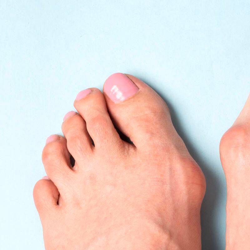 Hvordan slipper man af med knyster?